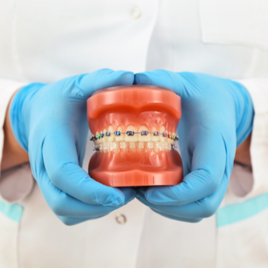 Dental Braces | Self Ligating Braces Cost in RR Nagar | Pragathi Dental Care