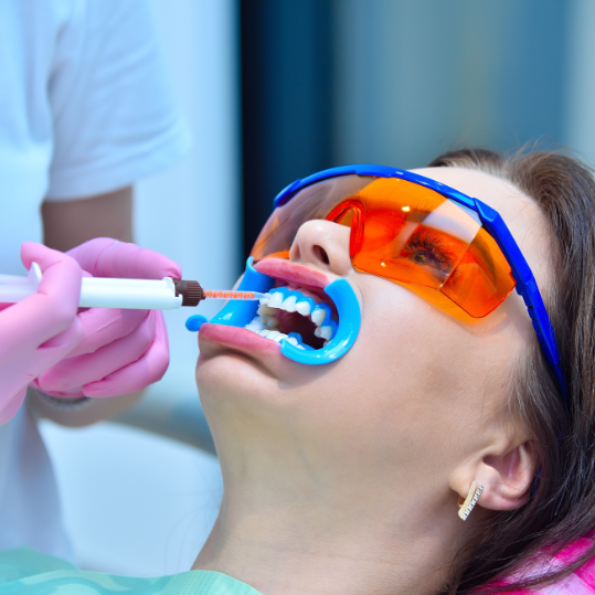 Tooth Whitening In RR Nagar - Pragathi Dental Care